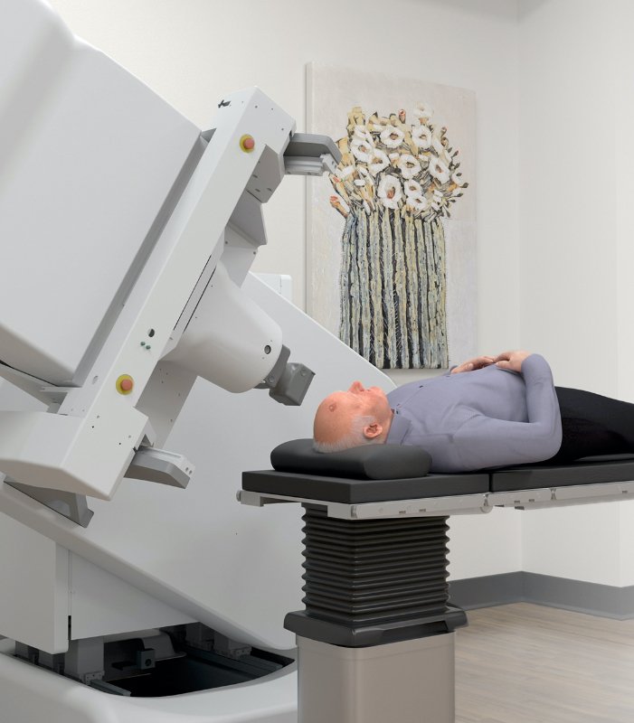 IntraOp