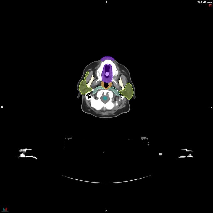 CT__SPINALCORD_0
