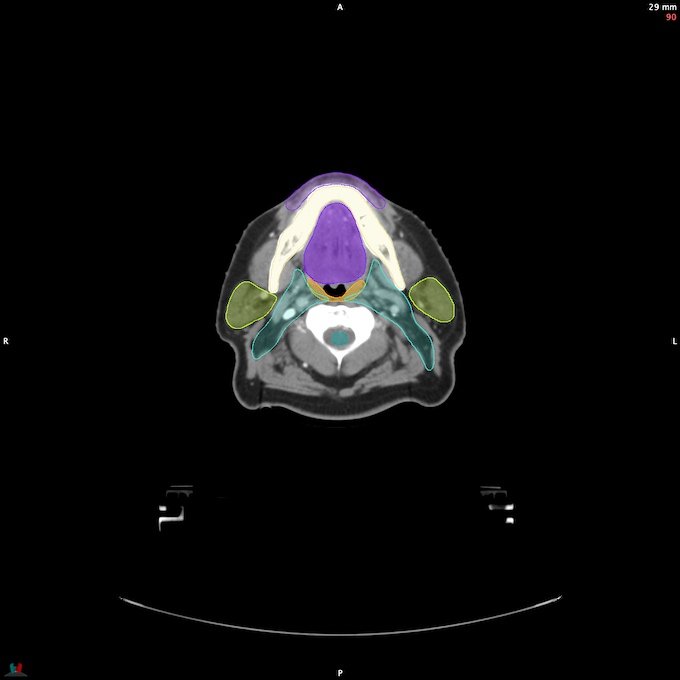 CT__SPINALCORD_13