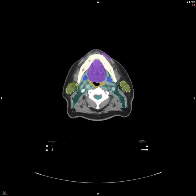 CT__SPINALCORD_16