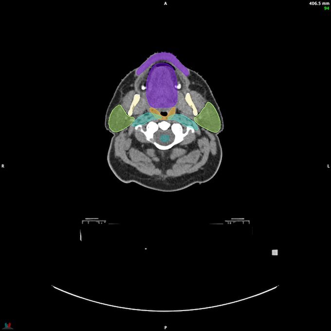 CT__SPINALCORD_5