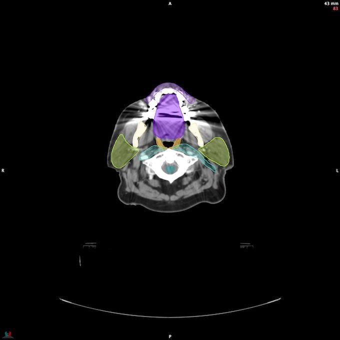 CT__SPINALCORD_6